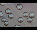 k.pneumoniae on blood agar